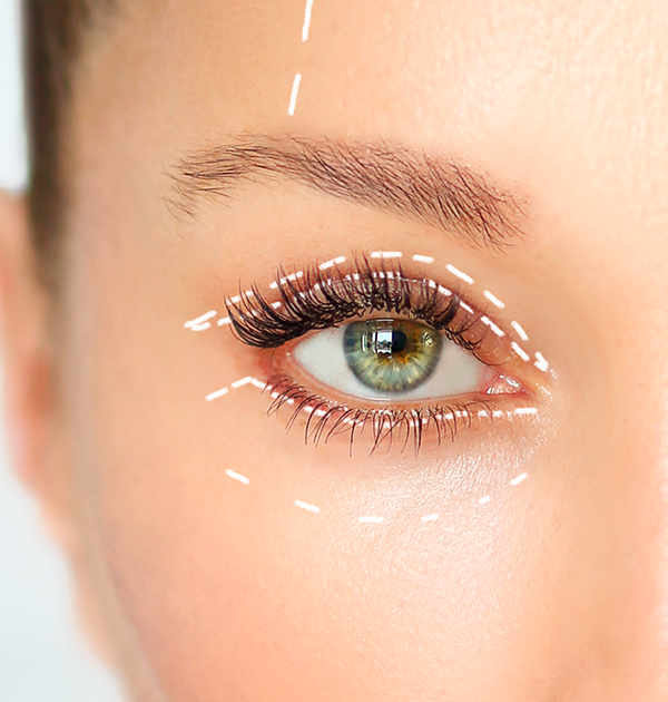 BLEFAROPLASTIA
