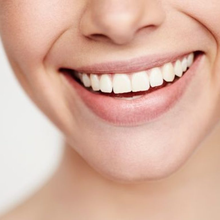 Sonrisa gingival antes y despues